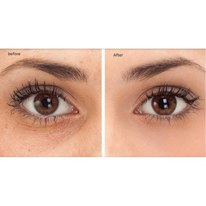 Dermaheal Dark Circle Solution