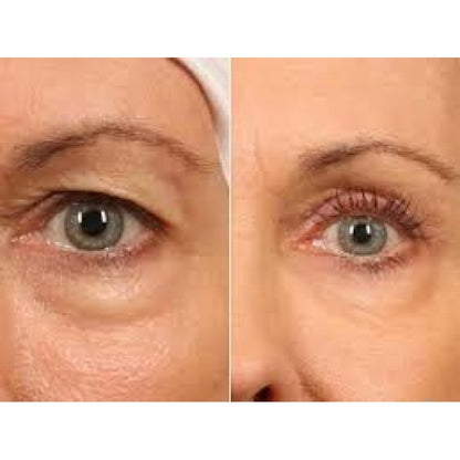 Dermaheal Eyebag Solution