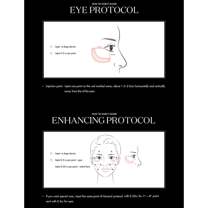 Gouri PCL (Polycaprolactone) Implant