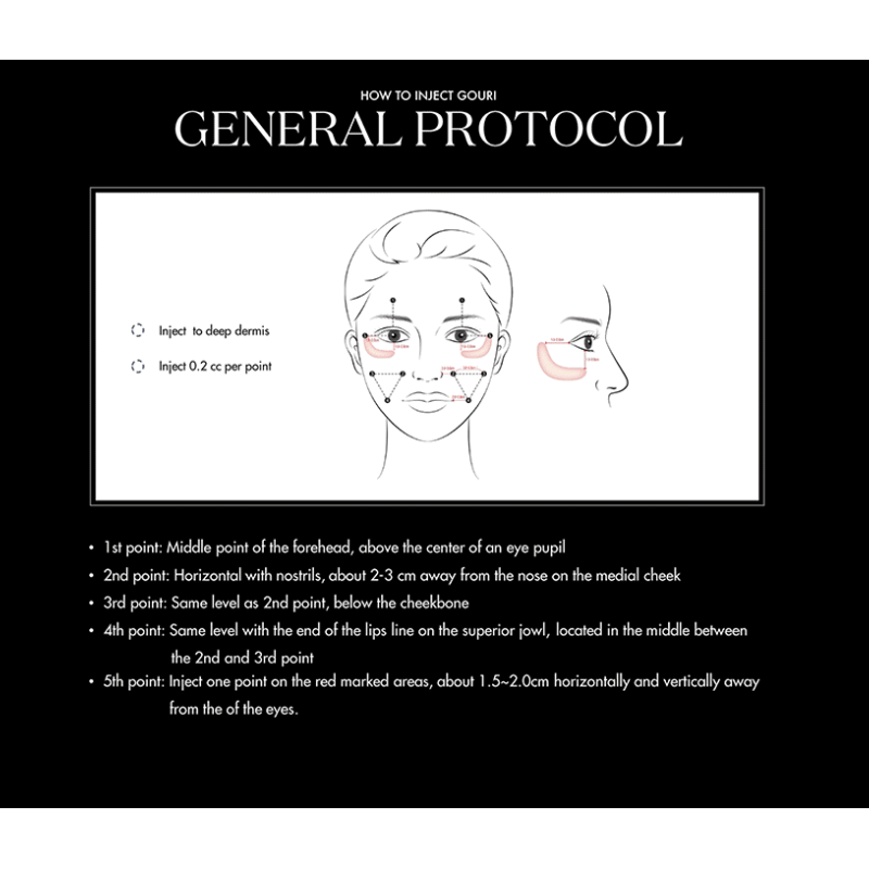 Gouri PCL (Polycaprolactone) Implant