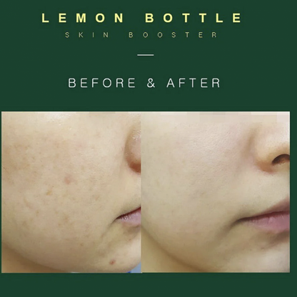Lemon Bottle Skin Booster