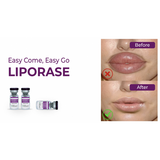 Liporase - Filler Dissolvant