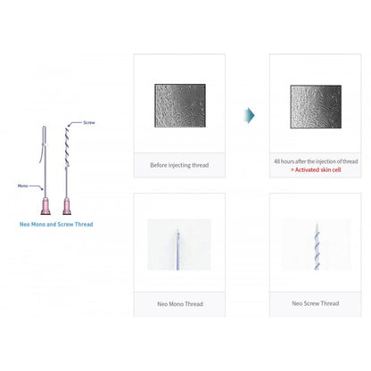 Neo Thread PDO Mono 30Gx25mm